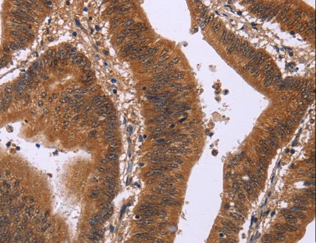 Polyclonal Rabbit anti-Human DCBLD2 Antibody (IHC)