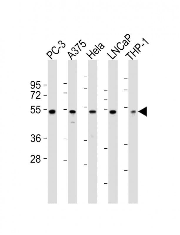 NFKBIE / IKB Epsilon Antibody (aa109-141)