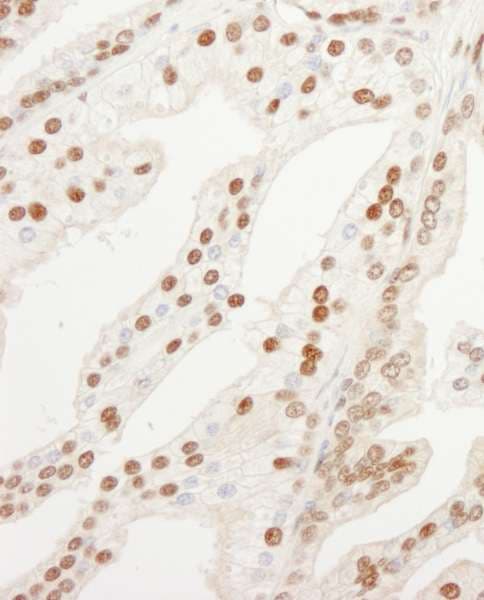 Polyclonal Rabbit anti-Human QIP1 / KPNA4 Antibody (aa471-521, IHC, WB)