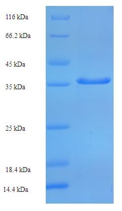 Human TBPL1 / TRF2 Protein (Recombinant His-SUMO)