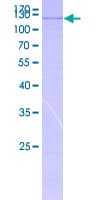 Human SEMA3C / Semaphorin 3C Protein (Recombinant GST)