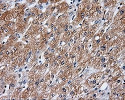 RIP1 / RALBP1 Antibody (clone OTI6E8)