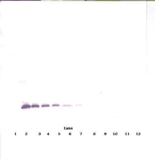 IHC-plus™ Polyclonal Rabbit anti-Human TIMP1 Antibody (aa24-207, IHC, WB)