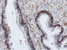 PFKP Antibody (clone OTI1A11)