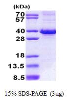 Human FBXO6 Protein (Recombinant His)