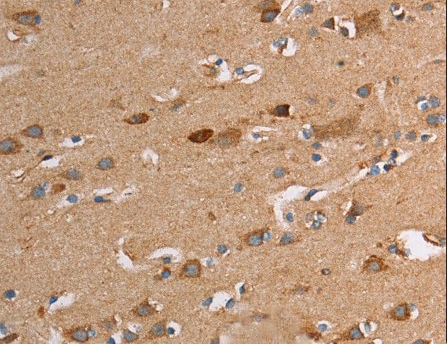 TLR8 Antibody