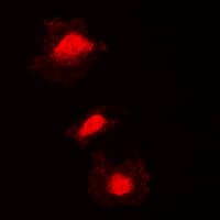 Polyclonal Rabbit anti-Human KIF2C / MCAK Antibody (N-Terminus, IF, WB)