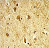 ADAMTS18 Antibody (aa1066-1095)