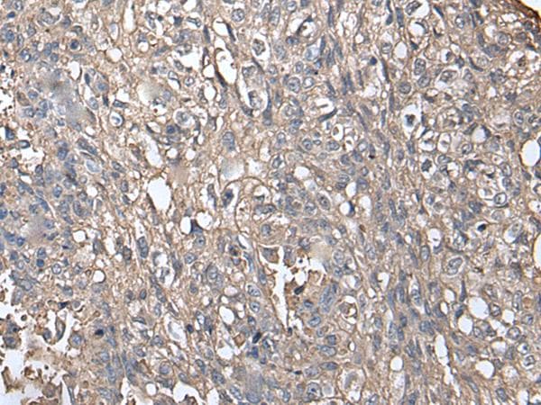 NDUFB5 Antibody
