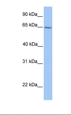 Polyclonal Rabbit anti-Human RXRB Antibody (FITC, aa151-200, WB)