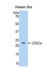 NOS2 / iNOS Antibody (aa43-213)