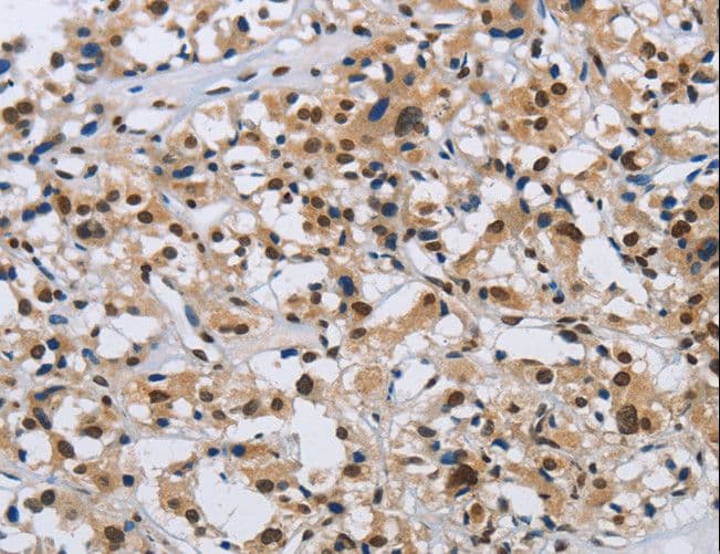 Polyclonal Rabbit anti-Human KPNB1 / Importin Beta Antibody (IHC)