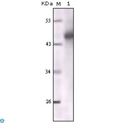 KRT5 / CK5 / Cytokeratin 5 Antibody