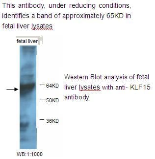 KLF15 Antibody