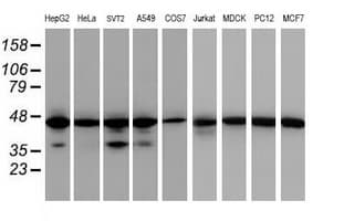 IDH1 / IDH Antibody (clone OTI24A2)