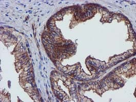 EPN2 Antibody (clone OTI1C2)
