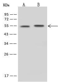 SLC30A10 Antibody