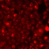 LCN2 / Lipocalin 2 / NGAL Antibody