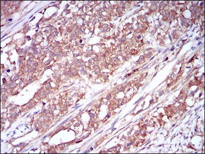 CSF1R / CD115 / FMS Antibody (aa344-497, clone 6B9H2)