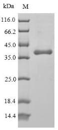 Human WNT5A Protein (Recombinant 6His, N-terminus)