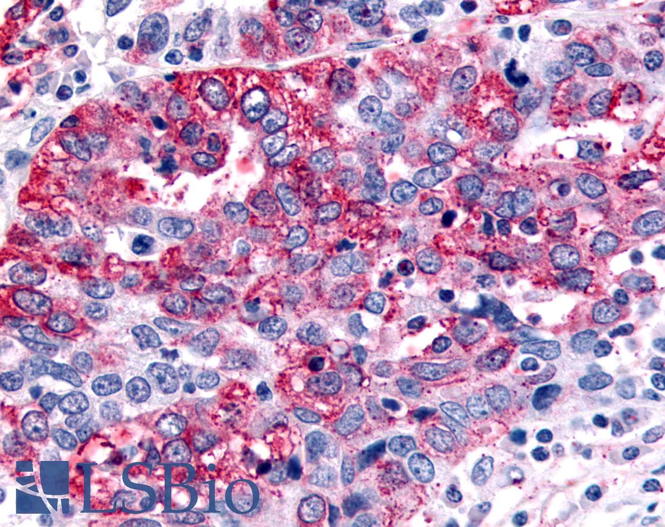 PathPlus™ GABBR1 / GABA B Receptor 1 Antibody (N-Terminus)