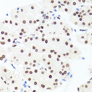 H1F0 Antibody