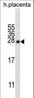 CRYBA1 Antibody (aa104-133)
