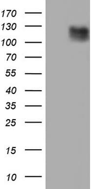 LAMB3 / Laminin Beta 3 Antibody (aa424-773, clone OTI2D11)