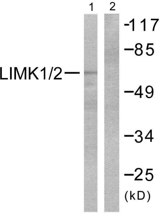 LIMK1 + LIMK2 Antibody (p508/505)