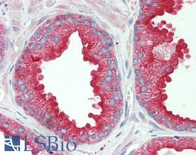 IHC-plus™ DNAJC5 / CSP Antibody (aa182-198)