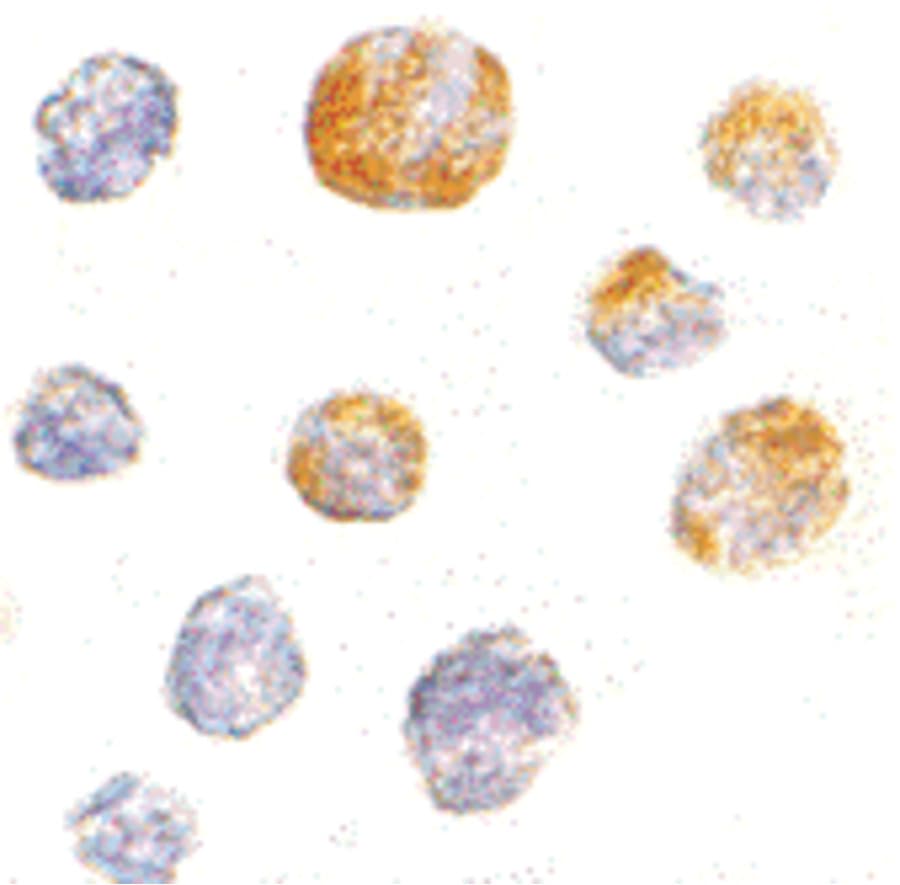 Polyclonal Rabbit anti-Human Kinesin 5A / KIF5A Antibody (IHC, IF, WB)