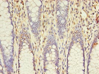 ACS5 / ACSL5 Antibody