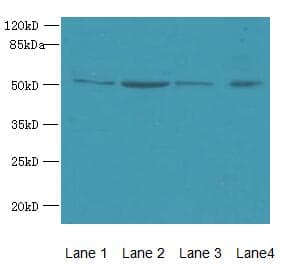 Polyclonal Rabbit anti-Human ZDHHC23 Antibody (IHC, WB)