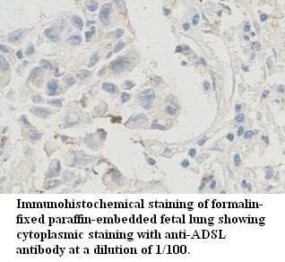 Polyclonal Rabbit anti-Human ADSL / Adenylosuccinate Lyase Antibody (aa202-441, IHC, WB)