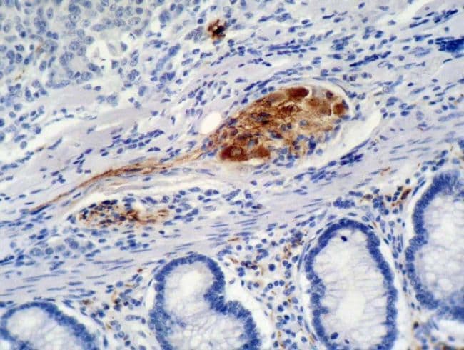 CDKN1B / p27 Kip1 Antibody (clone WA-1)