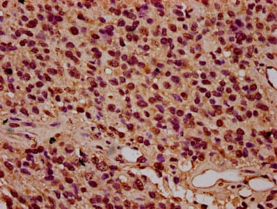 Polyclonal Rabbit anti-Human HIST1H3A Antibody (IHC, WB)