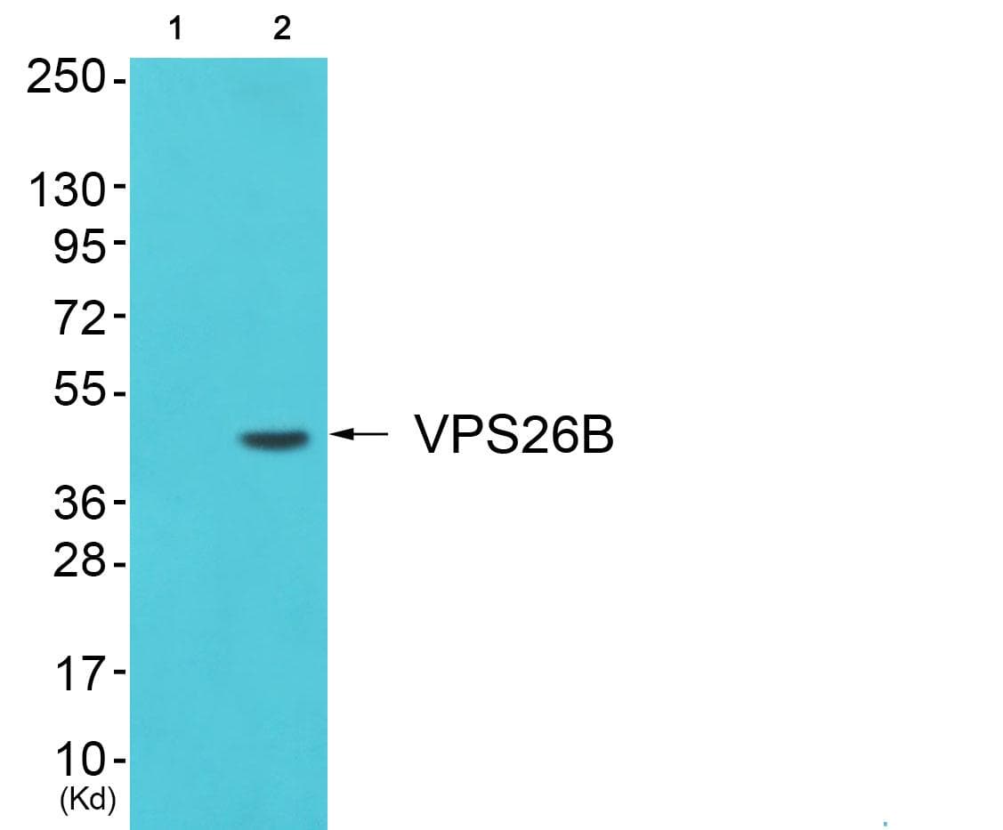 Polyclonal Rabbit anti-Human VPS26B Antibody (WB)