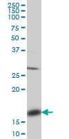 IHC-plus™ ACP1 / Acid Phosphatase Antibody (clone 4B10)