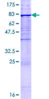 Human UGT1A9 Protein (Recombinant GST)