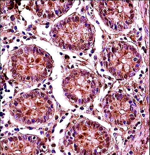 SMC1B Antibody (aa737-765)