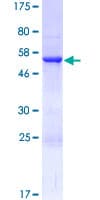 Human RABL2A Protein (Recombinant GST)