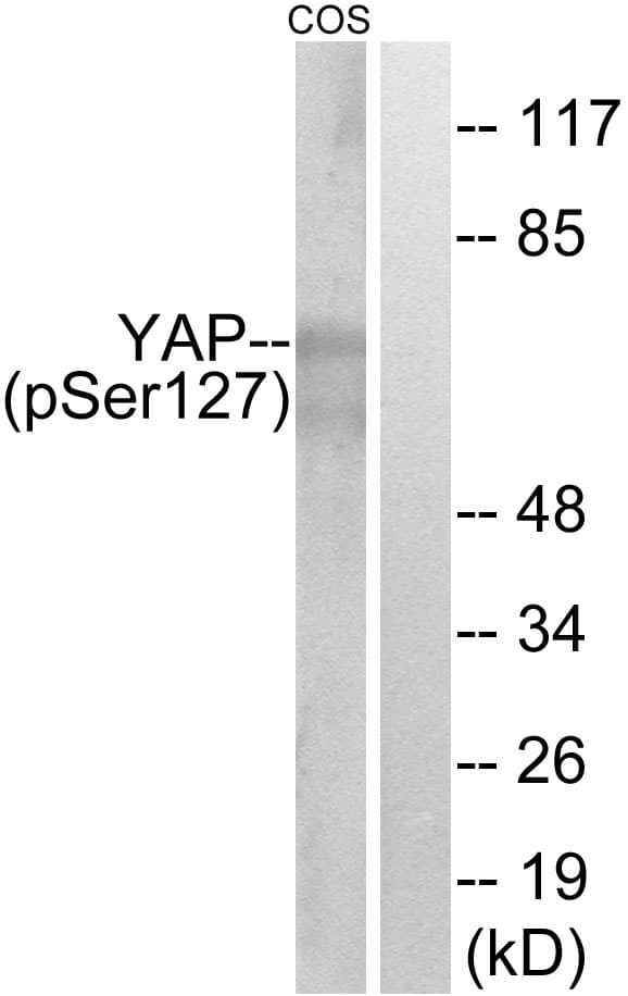 YAP / YAP1 Antibody (phospho-Ser127)