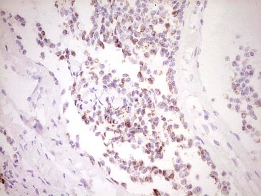 FOS / c-FOS Antibody (clone OTI7D6)