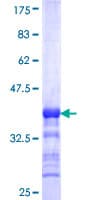 Human IP6K1 Protein (Recombinant GST, N-terminus)