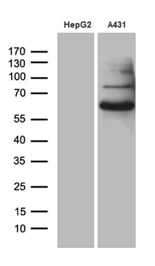 PCSK9 Antibody (aa153-692, clone OTI4G9)