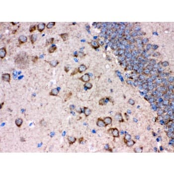 APBB1 / FE65 Antibody (aa21-56)