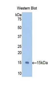 AGRP Antibody (aa34-130)