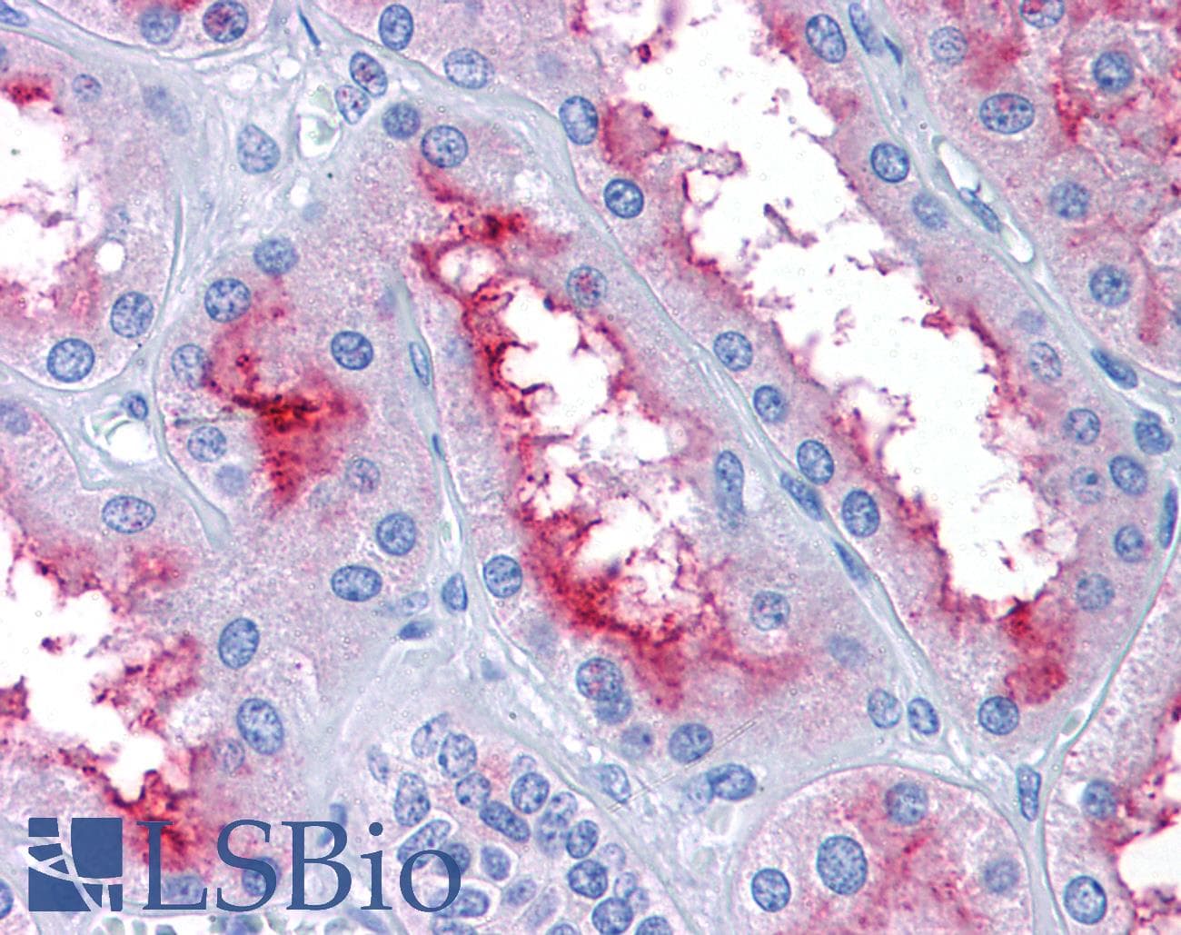 IHC-plus™ GCC2 Antibody (aa1174-1185)