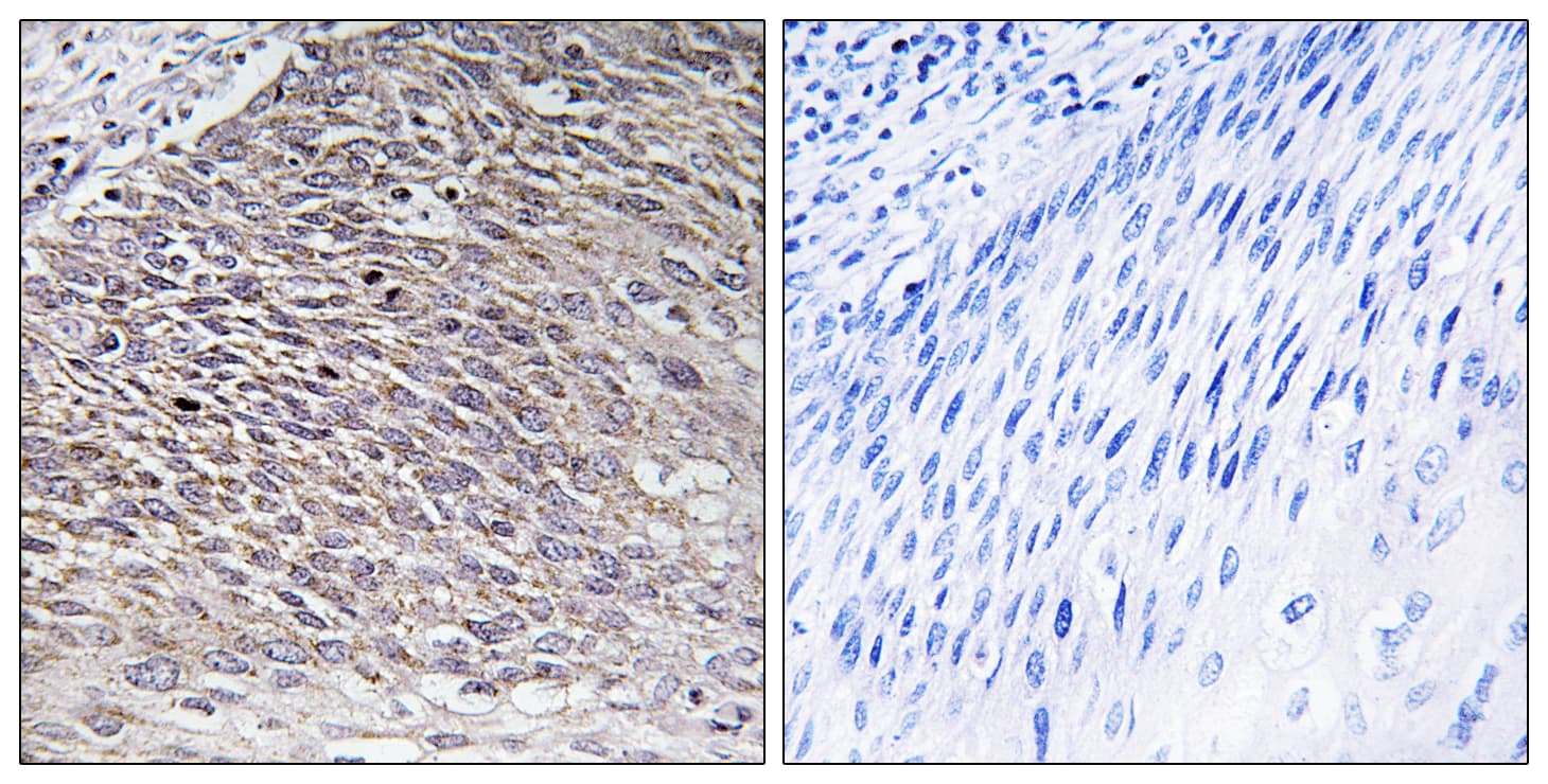 MAST4 Antibody (aa251-300)