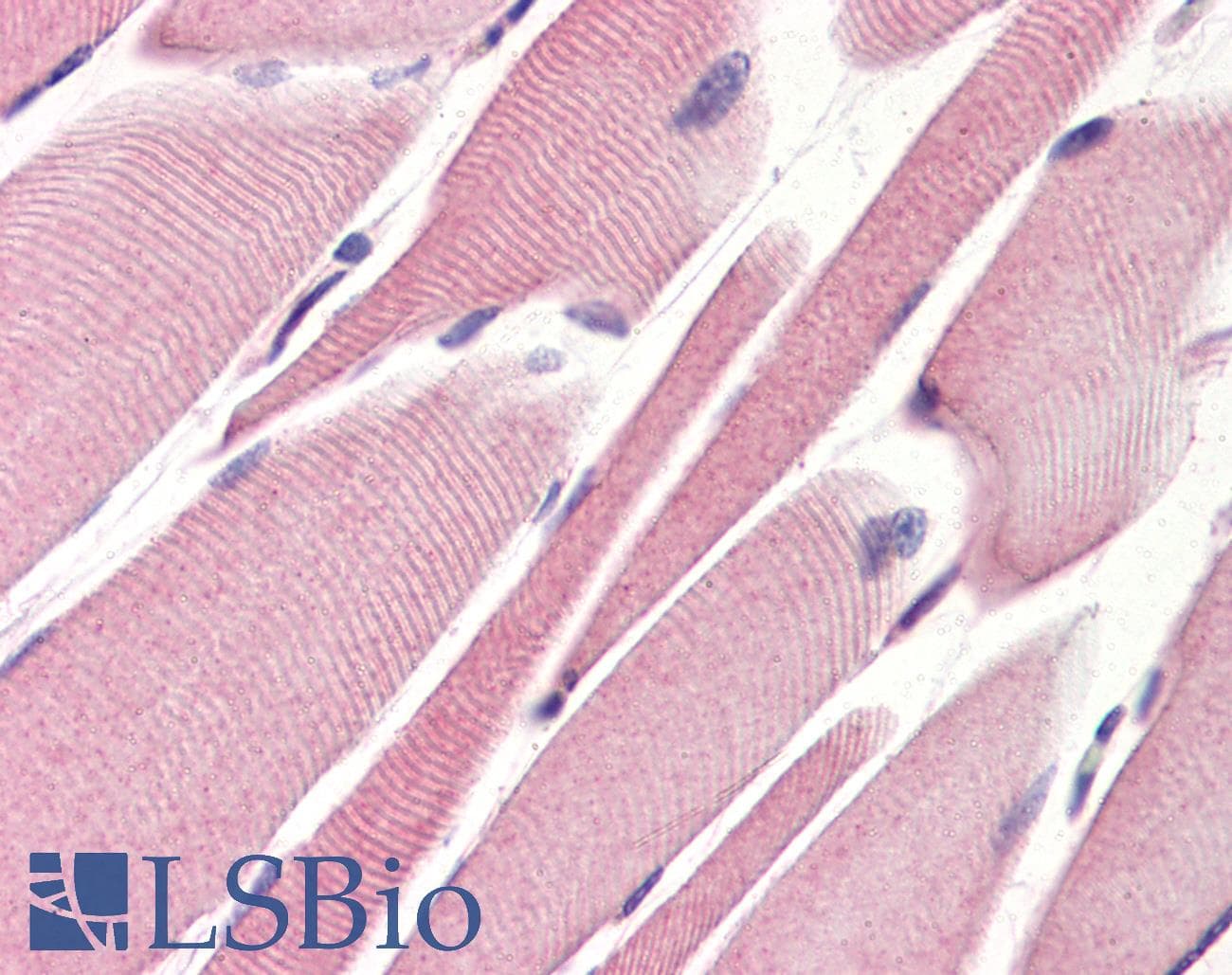 IHC-plus™ Monoclonal Mouse anti-Human STEAP1 / STEAP Antibody (clone J2D2, aa1-70, IHC, IF, WB)
